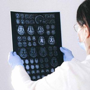 Diploma de Especialización en Neurología